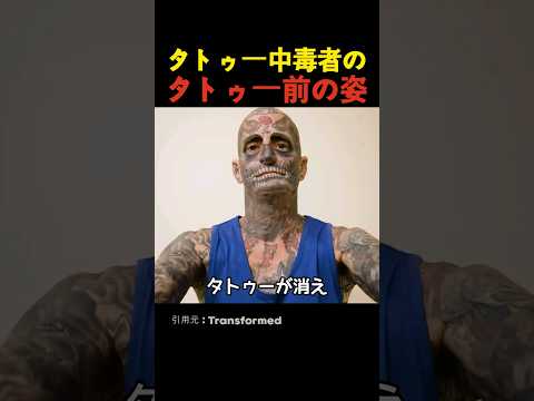 タトゥー中毒者のタトゥー前の姿